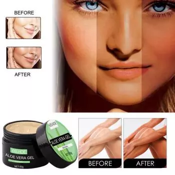 Солнцезащитный крем для восстановления, нераздражающий, увлажняющий, длительный, полезный для восстановления ран, гель-крем с алоэ вера для женщин 50ML