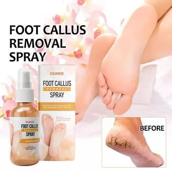 Спрей для ног для очистки омертвевшей кожи, кутина, мозолей, предотвращения сухости, трещин и увлажнения кожи. 30ml
