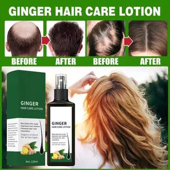 Спрей для роста волос Лосьон для ухода за жесткими волосами Повреждение волос головы 120 мл One Size чёрный