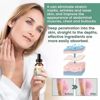 Спрей для сжигания жира, сексуальное масло для тела, спрей для похудения, сжигатель жира, для похудения, укрепляющий, для уменьшения целлюлита 5ml