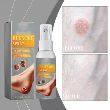 Спрей для ухода за кожей, увлажняющий уход за сухой и грубой кожей, нежный уход, спрей 30 мл One Size