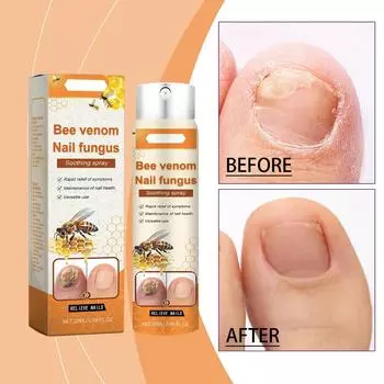 Спрей для ухода за ногтями, очищающий и увлажняющий спрей для ухода за ногтями 20 мл One Size