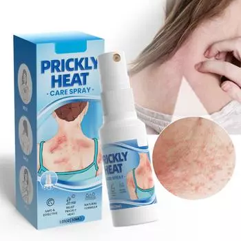 Спрей от потницы, быстрое облегчение зуда 30 мл