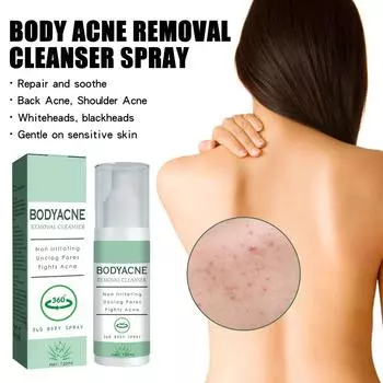 Спрей от прыщей на спине, спрей от прыщей на спине, сыворотка от прыщей на спине, увлажняющий крем для тела от прыщей, уменьшение прыщей на спине и прыщах на теле, скраб для спины, глубокое очищение, 120 мл