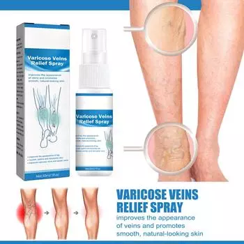 Спрей от варикозного расширения вен, успокаивающий спрей от варикозного расширения вен, спрей от варикозного расширения вен, укрепляет здоровье капилляров и улучшает кровообращение 30мл