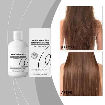 Спрей против выпадения волос укрепляет волосы, глубоко увлажняет кожу головы, улучшает циркуляцию крови и устраняет сухость, 100 мл белый