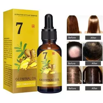 Средства для роста волос с имбирем. Эфирное масло для быстрорастущих волос. Натуральное средство против выпадения волос. Предотвращает сухость волос. Вьющиеся поврежденные волосы. Восстанавливающий уход. 10 ml