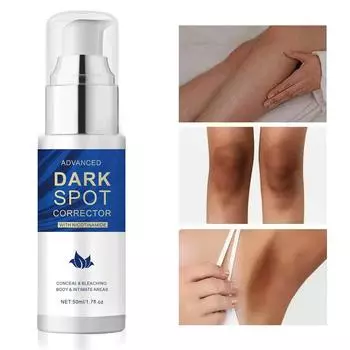 Средство для удаления темной гиперпигментации на лице, сыворотка для удаления темной гиперпигментации, старения, коричневого цвета, акне, мелазмы, коричневого цвета, дозировка с ниацинамидом для женщин и мужчин 50 мл One Size