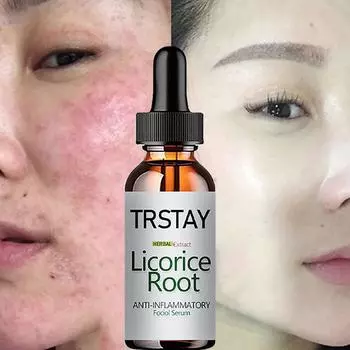 Средство для удаления темных кругов, уход за глазами, отбеливающий крем для лица для женщин crema para manchas en la piel, отбеливающий крем для кожи 5ml