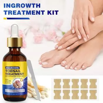 Средство от онихомикоза, утолщающее яркое средство от онихомикоза, мягкое средство от онихомикоза, средство для ухода за ногтями рук и ног 60 мл One size жёлтый