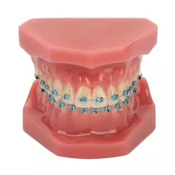 Стоматологическая ортодонтическая модель зубов 28 шт., смоляные зубы, обучающая модель зубов с металлическими брекетами