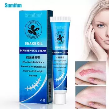 Sumifun 1 шт. восстанавливающий крем от шрамов антибактериальная мазь для удаления растяжек ожоги/порезы исчезают крем от прыщей контроль сужения пор шрам