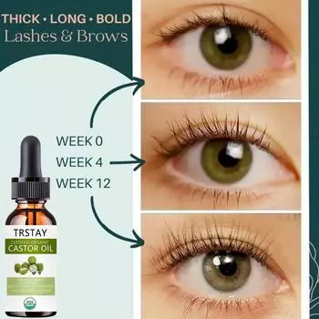 Сыворотка-эссенция для роста волос для женщин и мужчин, против выпадения волос, алопеции, жидкости, восстановления поврежденных волос, которые растут быстрее 5ml