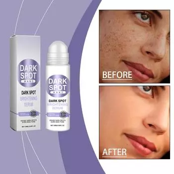 Сыворотка от веснушек помогает осветлить пятна на лице для разных типов кожи. Используйте постоянно для выравнивания тона кожи20 мл One Size