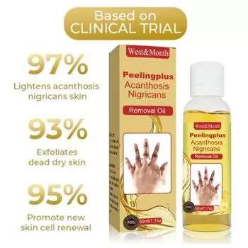 Темная кожа Масло для удаления меланина Увлажняет состояние кожи Отшелушивает кожу рук Локоть Колено Удаление омертвевшей кожи Корректор пигментов Отбеливает Украшает кожу 50ML