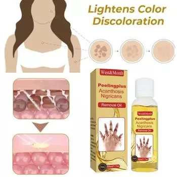 Темная кожа Масло для удаления меланина Увлажняет состояние кожи Отшелушивает кожу рук Локоть Колено Удаление омертвевшей кожи Корректор пигментов Отбеливает Украшает кожу 50ML