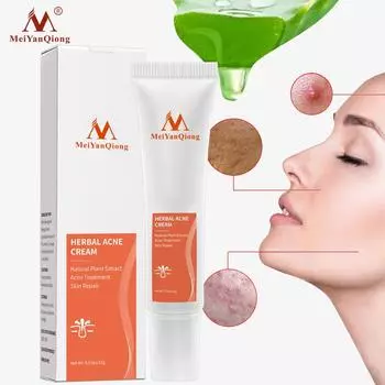 Травяной крем для лица против прыщей и морщин, 15 г 1pcs