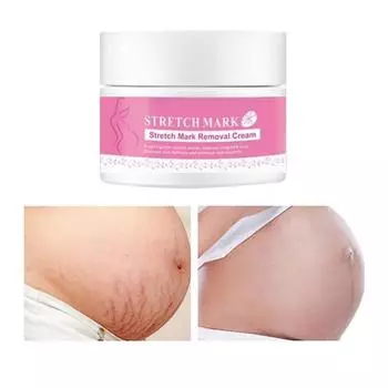 Удаление крема от шрамов от прыщей, лечение жировых шрамов, стрий беременных 5G