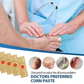 Удаление мозолей на ногах, подошвенных мозолей 10pcs