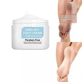 Уход за ногами Крем с мочевиной Скраб для ног Салициловая кислота отшелушивает мозоли Увлажняющий крем для восстановления кожи Крем для ног для удаления омертвевшей кожи 5G