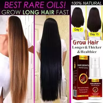 Уход за волосами и кожей головы Уход за волосами и кожей головы Сыворотка-спрей для роста волос Fast Liquid Treatment Уход за кожей головы Волосяной фолликул Естественная красота Здоровье Уход за волосами 20ML