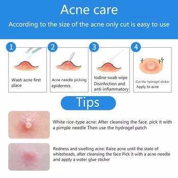 Ультратонкая гидроколлоидная клейкая повязка, повязка на рану, тонкая заживляющая прозрачная подушечка, дышащая, водонепроницаемая