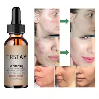 Уменьшает появление возрастных пятен, увлажняющий лосьон для лица, восстанавливает сухую кожу, защищает кожу, улучшает качество кожи 5ml