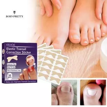 Универсальные украшения для вросших ногтей для педикюра, мини-водонепроницаемый патч-карандаш 50pcs