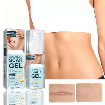 Усовершенствованный гель, 1,7 унции, с ретинолом, аллантоином и средством для тела, лица, против растяжек, келоидных рубцов, акне, ожогов. One Size