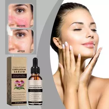 Успокаивающая сыворотка для кожи с эхинацеей улучшает состояние кожи, снимает покраснения и устраняет дискомфорт кожи (60мл) One Size