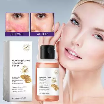 Успокаивающий тоник, увлажняющий, осветляющий, спрей для контроля жирности кожи, для чувствительной кожи, универсальный, отбеливающий, увлажняющий лосьон, универсальный, 100 мл One Size белый
