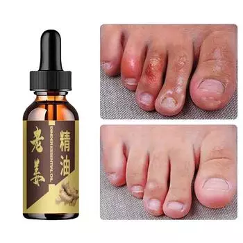 Устраните запах ног и зуд с помощью натуральных эфирных масел 5ml