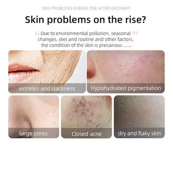 Устройство для красоты лица 4-в-1, светодиодная терапия красным светом, палочка для ухода за кожей лица, микротоковая палочка для лица и глаз 0 розовый