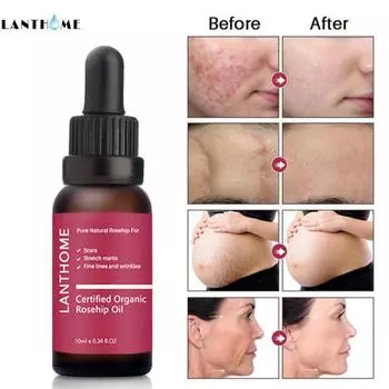 Увлажняющая эссенция для восстановления темных пятен и шрамов, осветляющая жидкость для удаления пятен