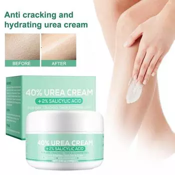 Увлажняющий крем для ног с мочевиной 40% для удаления омертвевшей кожи ног, плюс 2% салициловая кислота 5,29 унций/150 г One Size