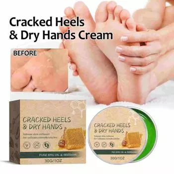 Увлажняющий крем для рук и ног с пчелиным воском. Уход за руками и ногами. Увлажняющий бальзам для рук и ног, уменьшает потрескавшиеся пятки и пятки, 1 унция/30 г. One Size белый