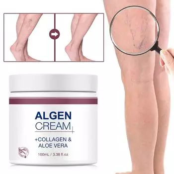 Увлажняющий крем для варикозного расширения вен, уход за ногами, «паучьи лапки», расслабление опухших и уставших ног, 100 мл One Size белый