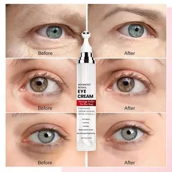 Увлажняющий крем для век Red Eye Roller, сияющий уход за кожей под глазами, 20 мл One Size белый