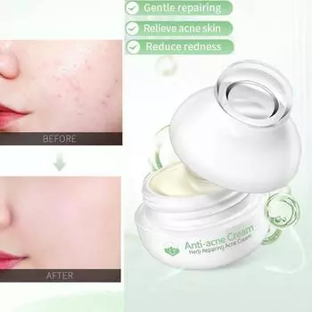 Увлажняющий крем против прыщей, крем от угрей, акне, восстанавливающий гель, контроль масла, сужение пор, шрам, уход за лицом, отбеливающая косметика 8g