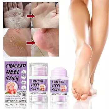 Увлажняющий стик для ног с мочевиной для сухих потрескавшихся пяток Увлажняющий крем для ног с мочевиной для сухих потрескавшихся пяток Увлажняющий крем для ног и рук белый