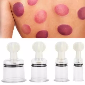 Вакуумные банки, акупунктурный массажер, облегчение боли, здравоохранение, банки M