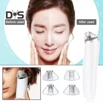 Вакуумный экстрактор угрей для удаления черных точек, поглотитель черных точек, электрическое средство для всасывания черных точек, зарядка через USB для мужчин и женщин, очиститель пор белый