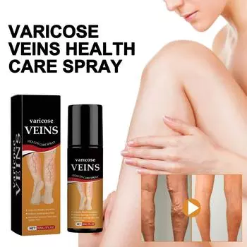 Варикозное расширение вен на ногах, спрей для ухода за венами, улучшает состояние капилляров, снимает варикозное расширение вен белый