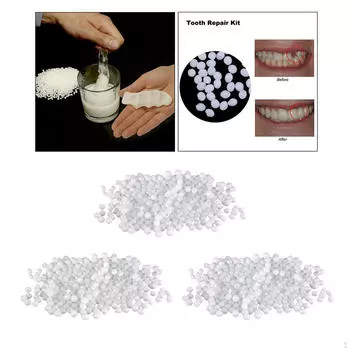 Виниры с термошариками, формованные для временного ремонта