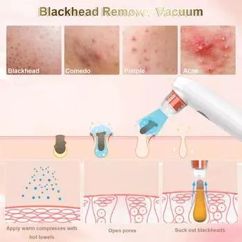 Визуальный инструмент для удаления черных точек с камерой, пылесос для чистки пор, удаление черных точек, прыщей, угрей, черных точек для чистки лица белый