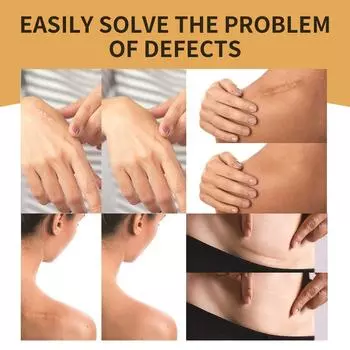 Водонепроницаемая пленка для татуировок, ультратонкая накладка, татуировка, шрам, татуировка, аксессуары, маскирующее покрытие для татуировок C2P8 skin color-6pcs