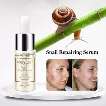 Восстанавливающая сыворотка с улитками, омолаживающая эссенция против прыщей, уход за кожей лица, питательная, увлажняющая
