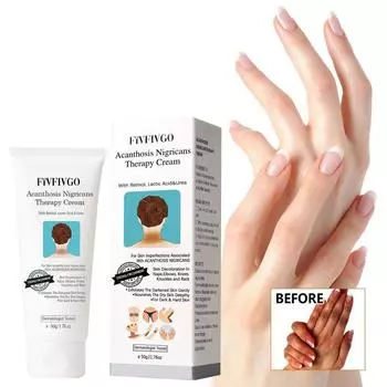 Восстанавливающий крем Ремонт подмышек Колени Руки Суставы Осветляющий темный увлажняющий отбеливающий крем для ухода за кожей 50g