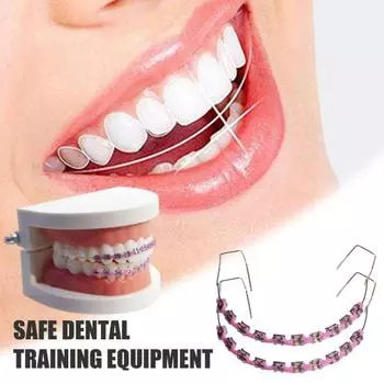 Временное украшение зубов металлической проволокой Брекеты Ортодонтические лигатуры Ортодонты объясняют Реквизиты для практики студентов-стоматологов светло-синий