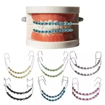 Временное украшение зубов металлической проволокой Брекеты Ортодонтические лигатуры Ортодонты объясняют стоматологию зелёный